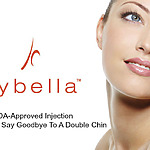 Double chin reduction with Kybella